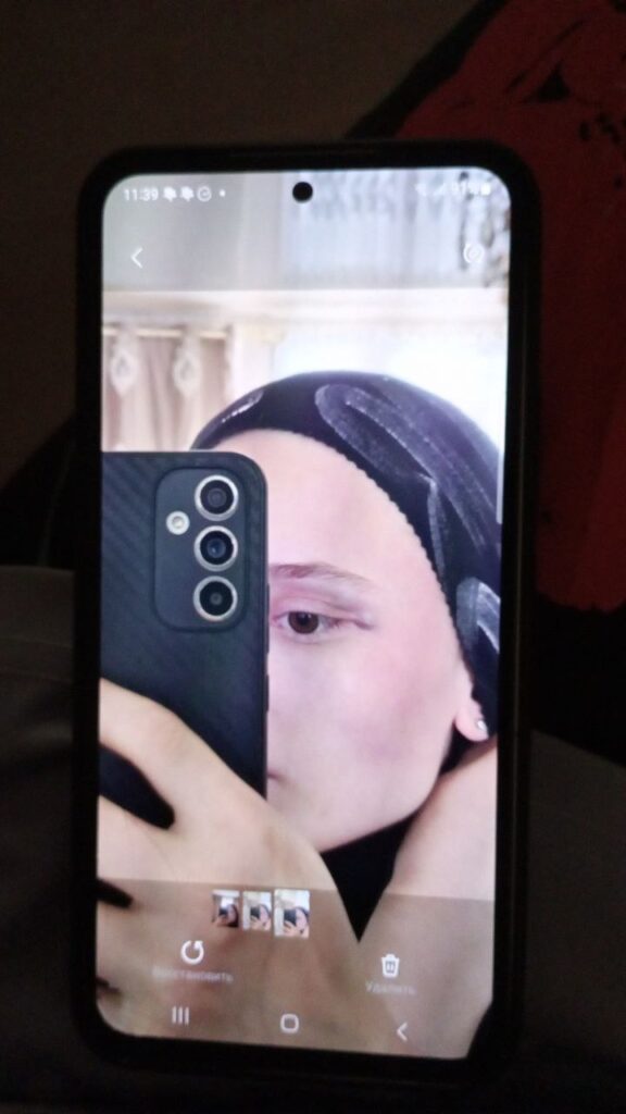 Фото побоев Айшат Баймурадовой